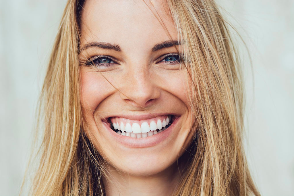 carillas dentales madrid